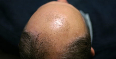 ConsultationandScalpAnalysis